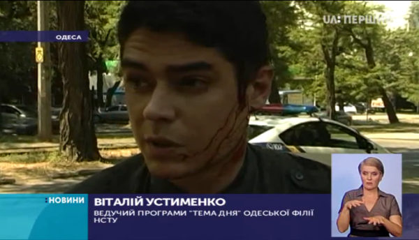 Невідомі напали з ножем на ведучого Одеської філії Суспільного Віталія Устименка